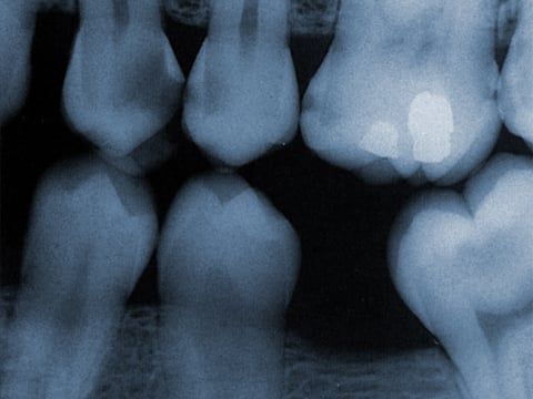 Teeth image