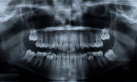 Teeth image